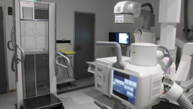 El número de estudios diagnósticos aumenta un 30% en el hospital de Ciudad tras la renovación de las salas de Radiología