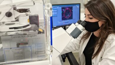 Una investigación de la UCLM identifica las proteínas responsables de la muerte neuronal y la inflamación en el alzhéimer / UCLM