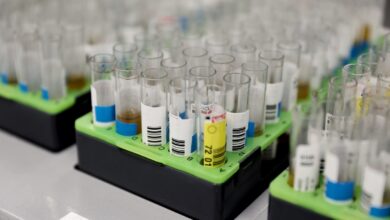 Prueba mircobiología viruela del mono / Imagen de archivo Europa Press